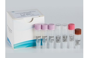 NS0&SP2/0残留DNA检测试剂盒